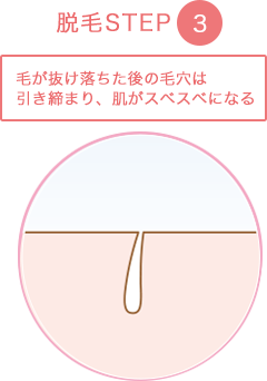 step3毛が抜け落ちた後の毛穴は引き締まり、肌がスベスベになる