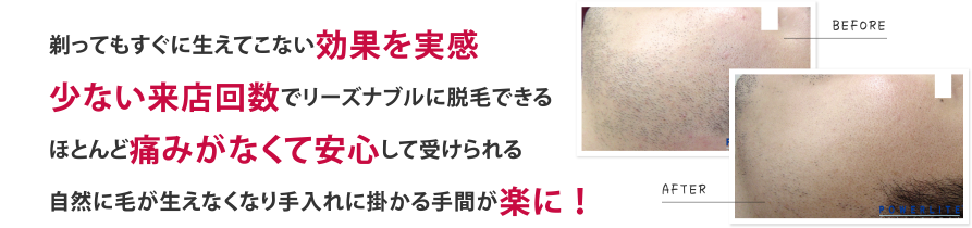 剃ってもすぐに生えてこない効果を実感 少ない来店回数でリーズナブルに脱毛できる ほとんど痛みがなくて安心して受けられる 自然に毛が生えなくなり手入れに掛かる手間が楽に！